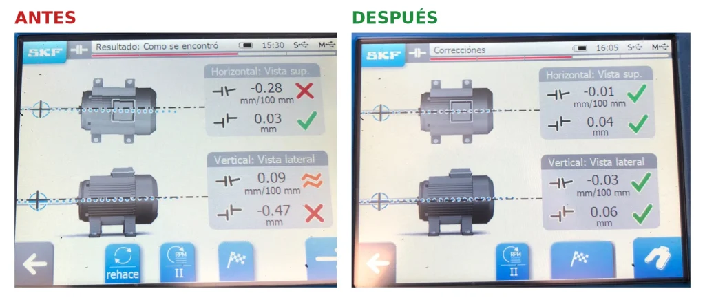 alineacion-laser-antes-despues